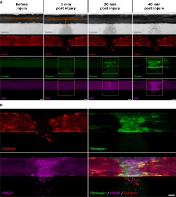 Complement inhibition can decrease the haemostatic response in a microvascular bleeding model at multiple levels
